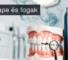 Vape hatása a fogakra – fogorvosi vizsgálat, fogak és vape eszköz